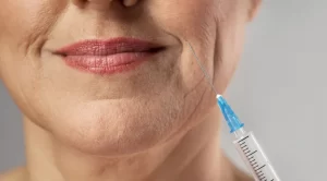 Agência reguladora dos EUA aprova injeção anti-rugas concorrente do Botox